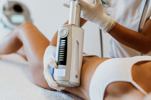 Endosphären-Körperbehandlung gegen Cellulite bei MyBody Augsburg