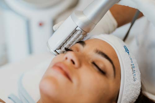 Endosphären-Gesichtsbehandlung bei MyBody Augsburg